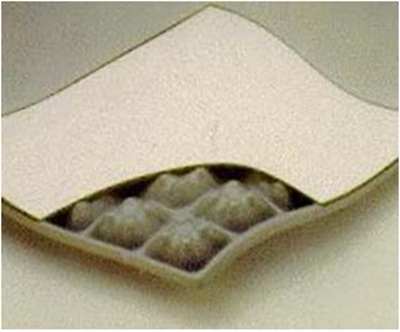 hu-hai-san-nang-ky-thuat-thuong-gap